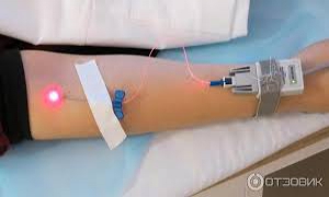 Лазерное и ультрафиолетовое облучение крови. - миниатюра-0 (Новороссийск)